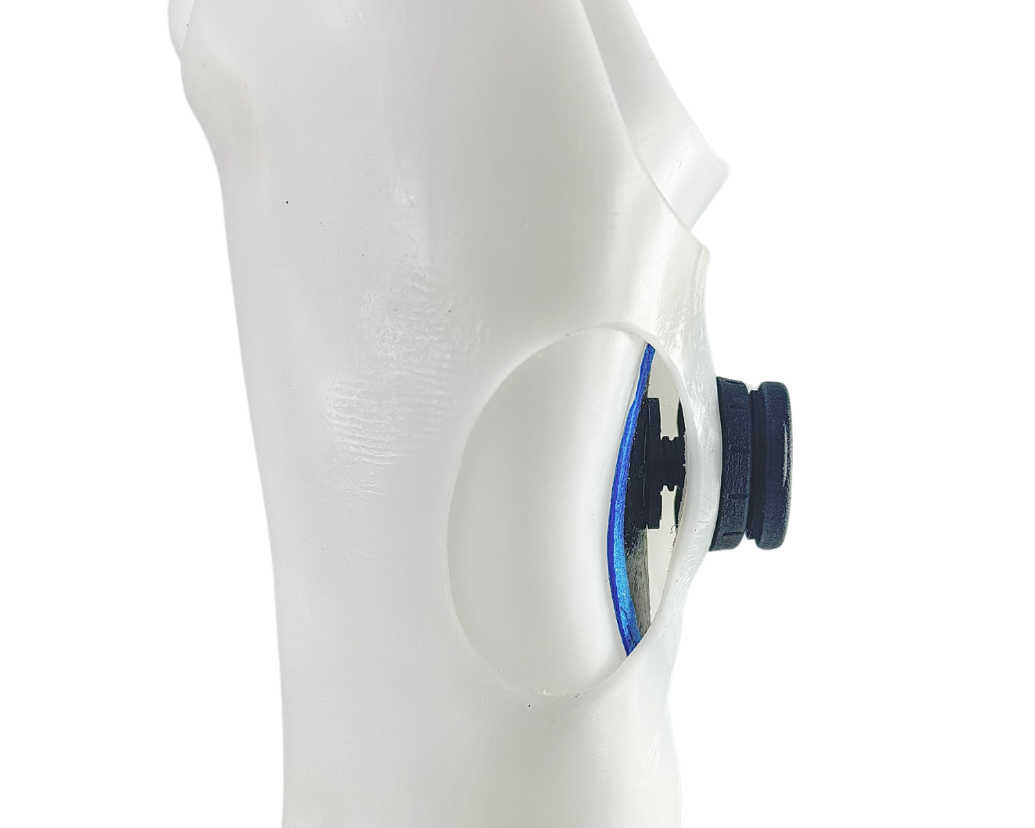 Clinical Corner: Adjustable Sockets – A Comparative Overview – Cascade ...